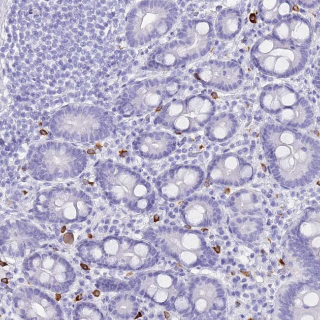 MYADML2 Antibody in Immunohistochemistry (Paraffin) (IHC (P))