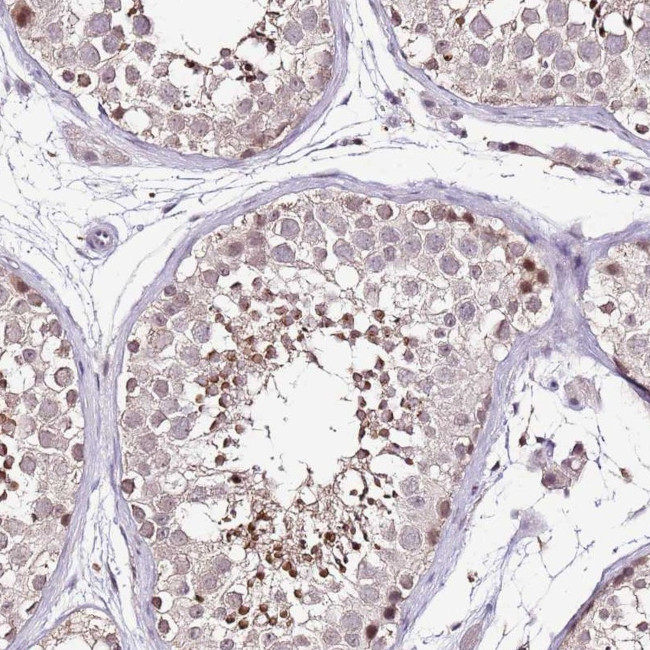 IZUMO4 Antibody in Immunohistochemistry (Paraffin) (IHC (P))