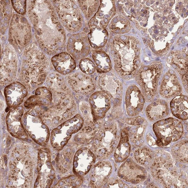 ANKRD24 Antibody in Immunohistochemistry (Paraffin) (IHC (P))