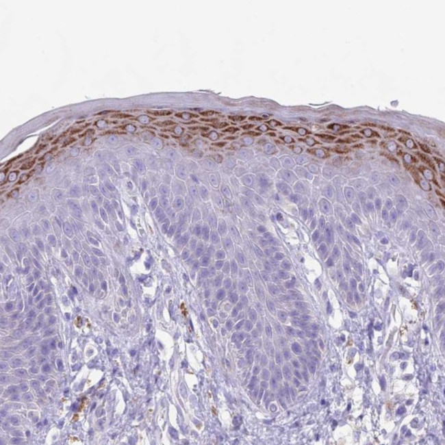 CLEC2A Antibody in Immunohistochemistry (Paraffin) (IHC (P))