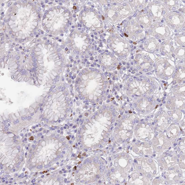TMEM251 Antibody in Immunohistochemistry (Paraffin) (IHC (P))