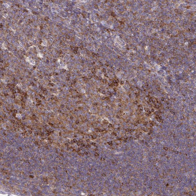 Asap1 Machine ASAP1 Polyclonal Antibody | Invitrogen (PA5-61770)