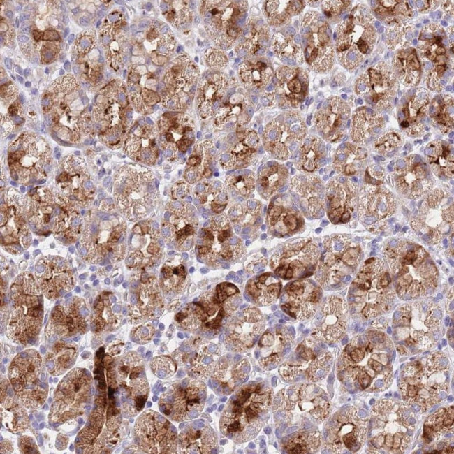 LIPJ Antibody in Immunohistochemistry (Paraffin) (IHC (P))