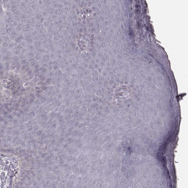 KRT74 Antibody in Immunohistochemistry (Paraffin) (IHC (P))