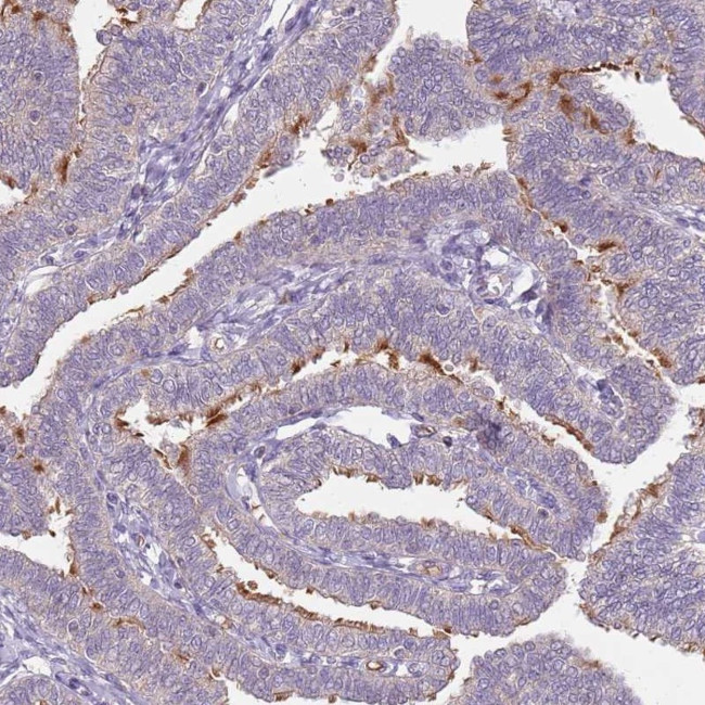 TEKT4 Antibody in Immunohistochemistry (IHC)