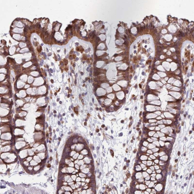 PPP1R27 Antibody in Immunohistochemistry (Paraffin) (IHC (P))