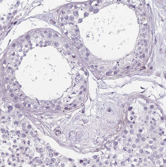 TMC4 Antibody in Immunohistochemistry (Paraffin) (IHC (P))