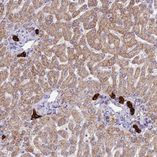 ZDHHC1 Antibody in Immunohistochemistry (Paraffin) (IHC (P))