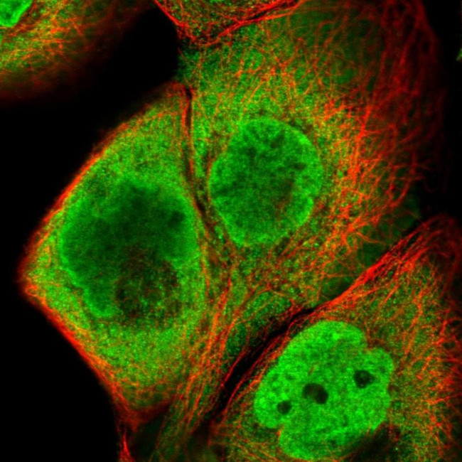 HIST1H2BC Antibody in Immunocytochemistry (ICC/IF)