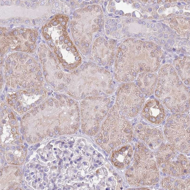 OR6M1 Antibody in Immunohistochemistry (Paraffin) (IHC (P))