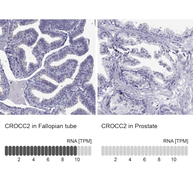CROCC2 Antibody in Immunohistochemistry (IHC)
