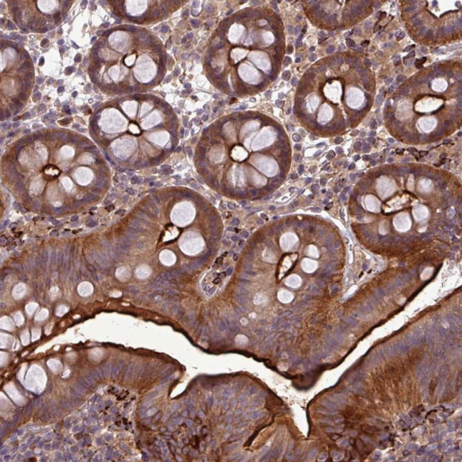 PAPLN Antibody in Immunohistochemistry (Paraffin) (IHC (P))