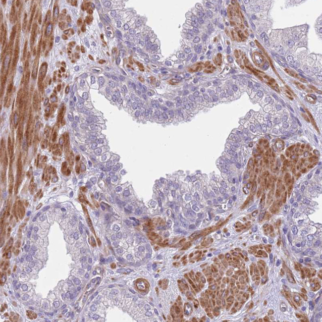 TINAGL1 Antibody in Immunohistochemistry (Paraffin) (IHC (P))