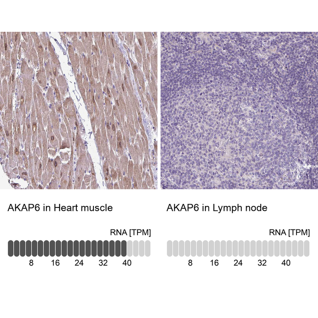 AKAP6 Antibody in Immunohistochemistry (Paraffin) (IHC (P))