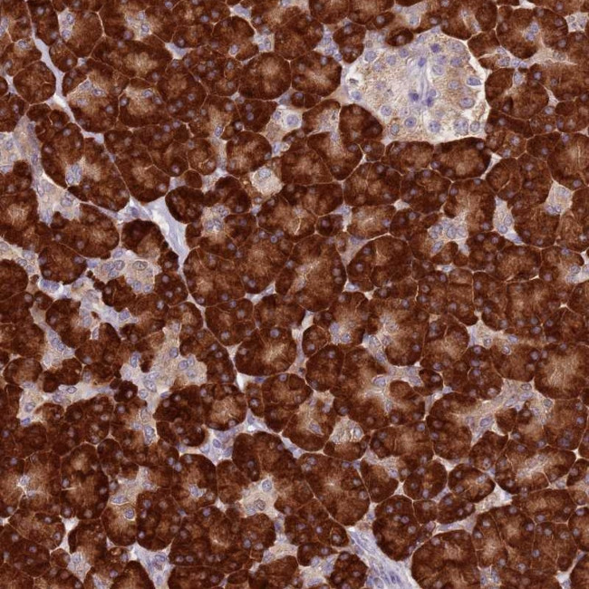 RPS9 Antibody in Immunohistochemistry (Paraffin) (IHC (P))
