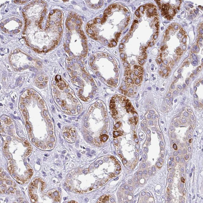 TMEM178B Antibody in Immunohistochemistry (Paraffin) (IHC (P))