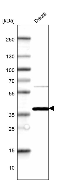 CCDC109B Antibody in Western Blot (WB)