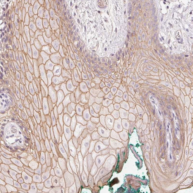 p53AIP1 Antibody in Immunohistochemistry (Paraffin) (IHC (P))