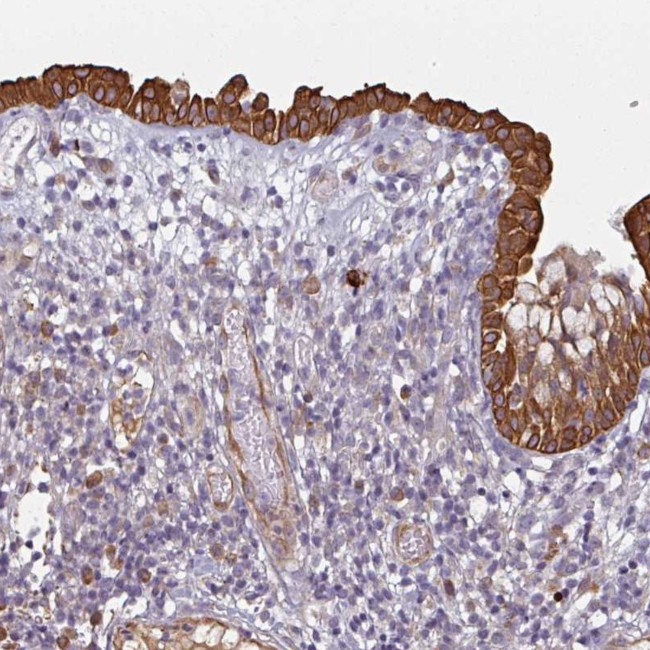 CEP78 Antibody in Immunohistochemistry (Paraffin) (IHC (P))