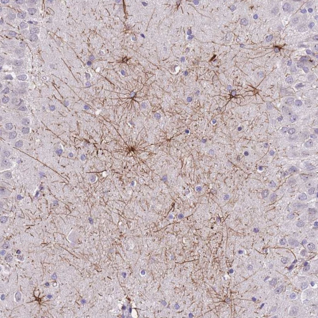SHCBP1 Antibody in Immunohistochemistry (Paraffin) (IHC (P))