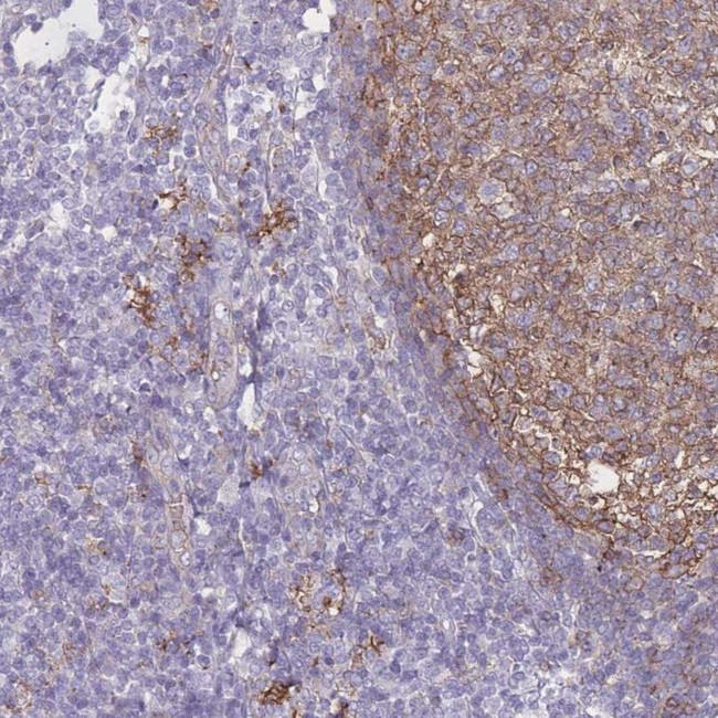 GNA11 Antibody in Immunohistochemistry (IHC)