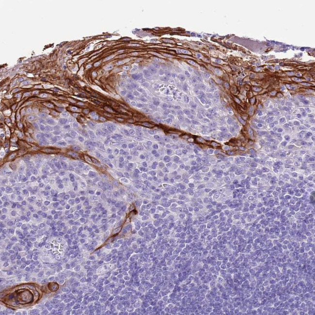TBC1D10B Antibody in Immunohistochemistry (Paraffin) (IHC (P))