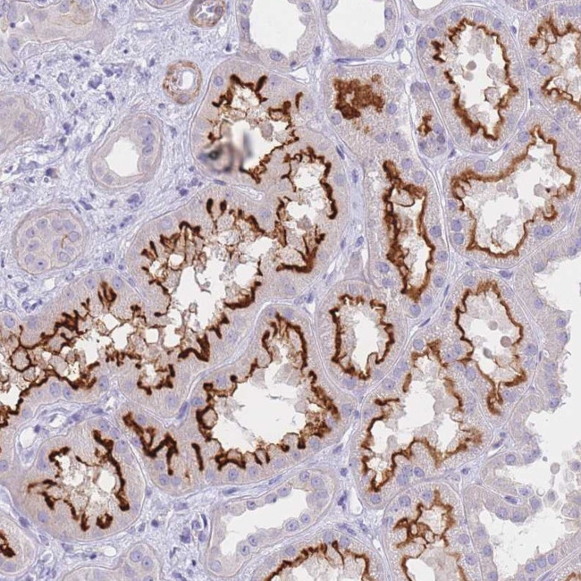 CHSY1 Antibody in Immunohistochemistry (Paraffin) (IHC (P))