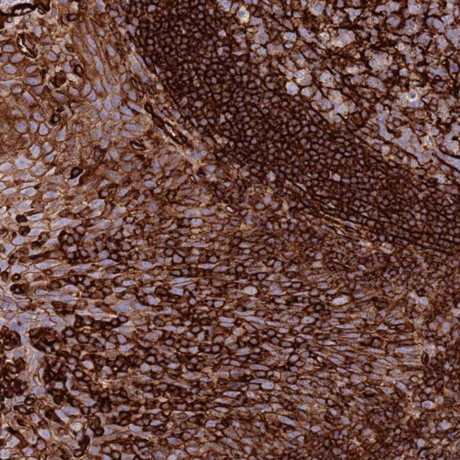KBTBD6 Antibody in Immunohistochemistry (Paraffin) (IHC (P))