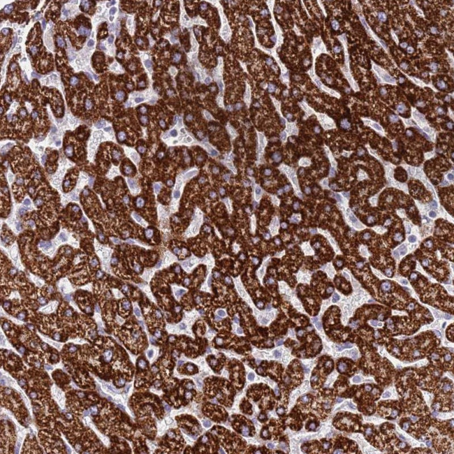 RNF222 Antibody in Immunohistochemistry (Paraffin) (IHC (P))
