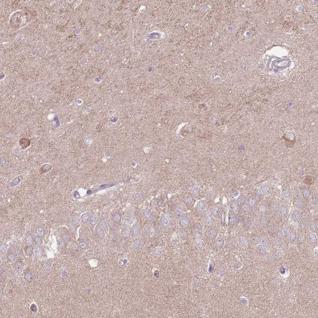 LRFN3 Antibody in Immunohistochemistry (Paraffin) (IHC (P))