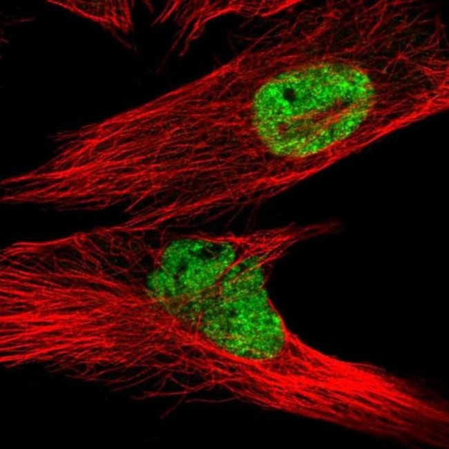 LPPR2 Antibody in Immunocytochemistry (ICC/IF)
