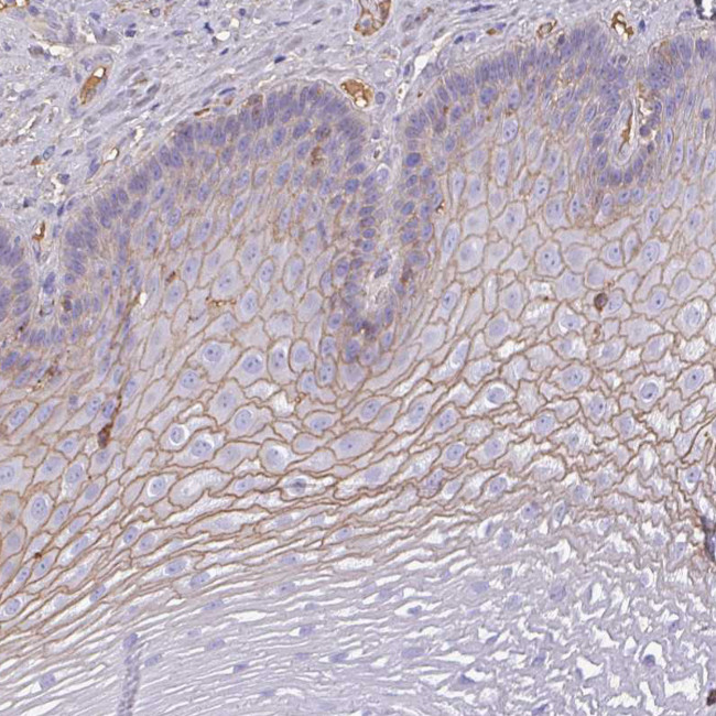 SMYD5 Antibody in Immunohistochemistry (Paraffin) (IHC (P))