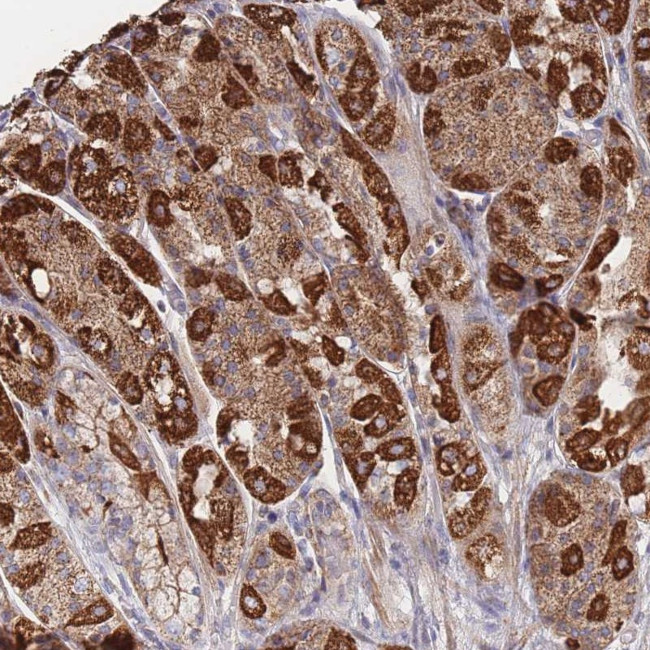 IKZF4 Antibody in Immunohistochemistry (Paraffin) (IHC (P))