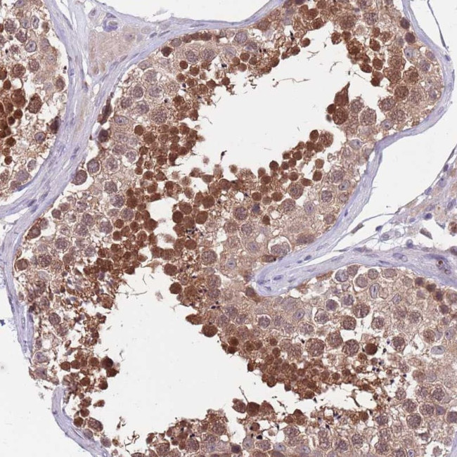 KLHL29 Antibody in Immunohistochemistry (Paraffin) (IHC (P))
