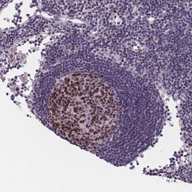 SAMD1 Antibody in Immunohistochemistry (Paraffin) (IHC (P))