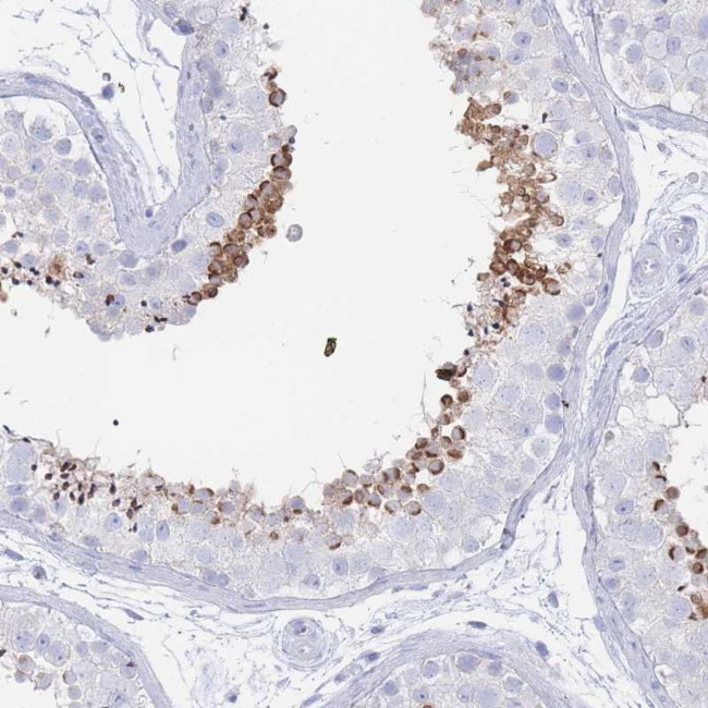 LRRC37A2 Antibody in Immunohistochemistry (Paraffin) (IHC (P))
