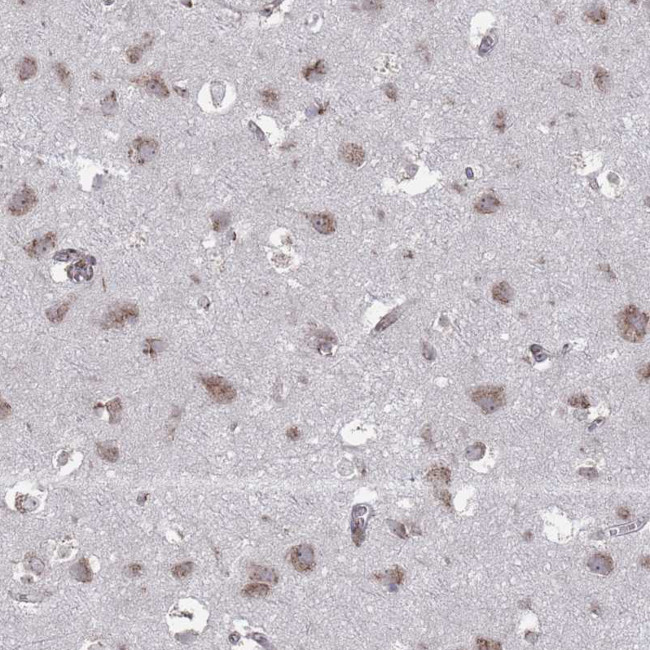 FMO4 Antibody in Immunohistochemistry (Paraffin) (IHC (P))