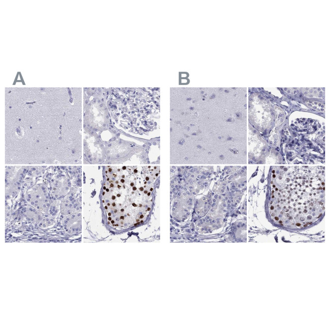 STAG3 Antibody in Immunohistochemistry (IHC)