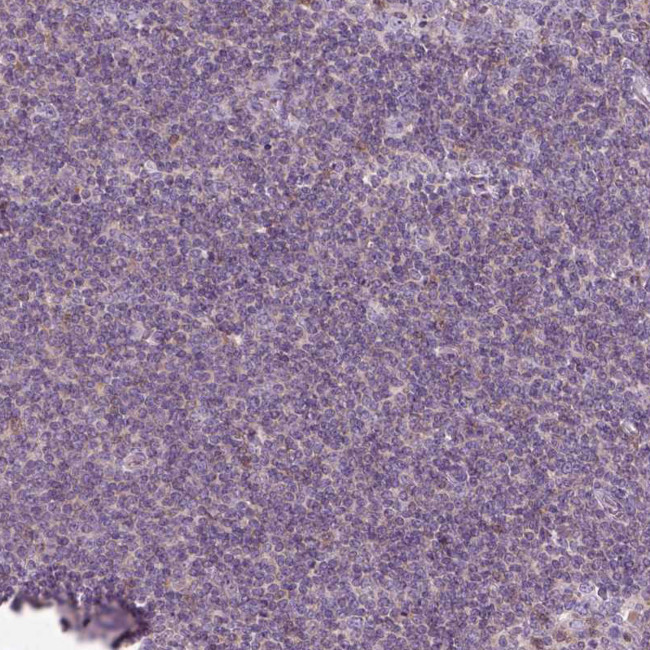 SLC1A7 Antibody in Immunohistochemistry (Paraffin) (IHC (P))
