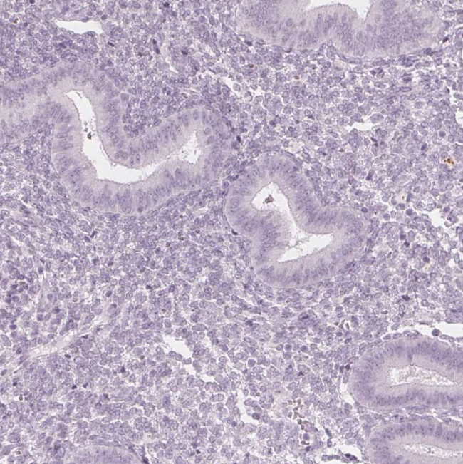 FAM55A Antibody in Immunohistochemistry (Paraffin) (IHC (P))