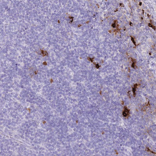 TPSB2 Antibody in Immunohistochemistry (Paraffin) (IHC (P))