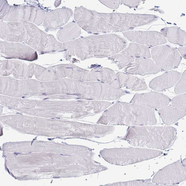 TFPI2 Antibody in Immunohistochemistry (Paraffin) (IHC (P))