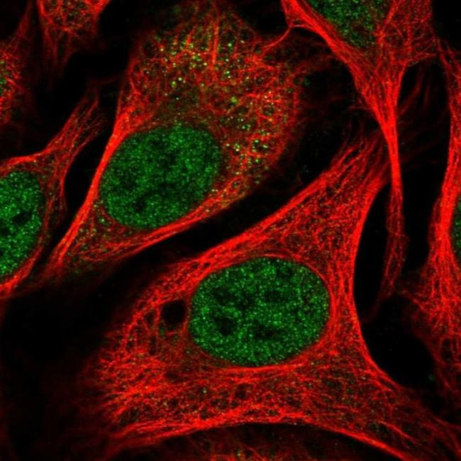 Parp8 Antibody in Immunocytochemistry (ICC/IF)