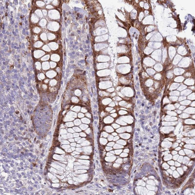 ANO8 Antibody in Immunohistochemistry (Paraffin) (IHC (P))