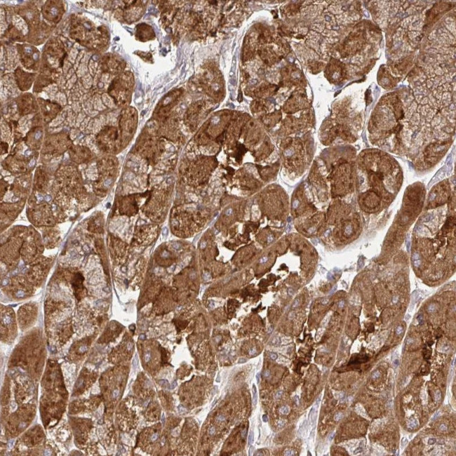 ZNF285 Antibody in Immunohistochemistry (Paraffin) (IHC (P))