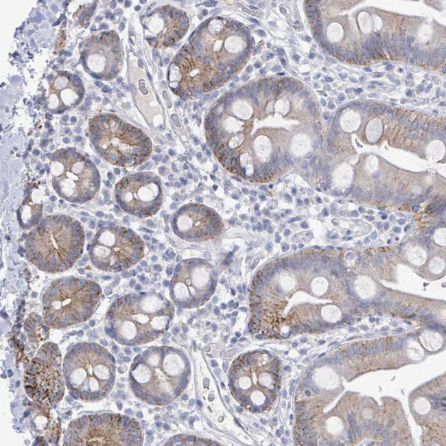 LCLAT1 Antibody in Immunohistochemistry (Paraffin) (IHC (P))