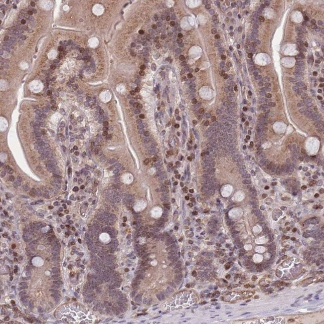 SLC35F5 Antibody in Immunohistochemistry (IHC)
