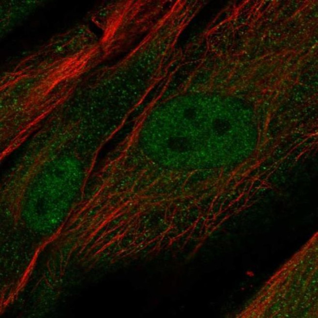 PRR16 Antibody in Immunocytochemistry (ICC/IF)