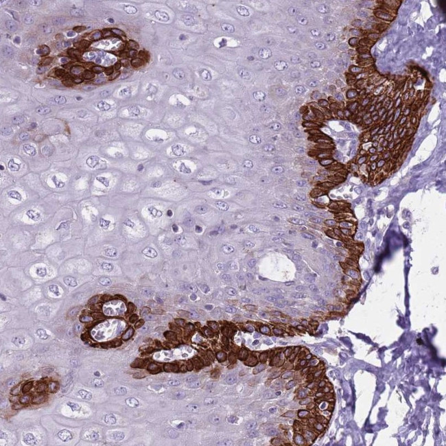 CNPPD1 Antibody in Immunohistochemistry (Paraffin) (IHC (P))