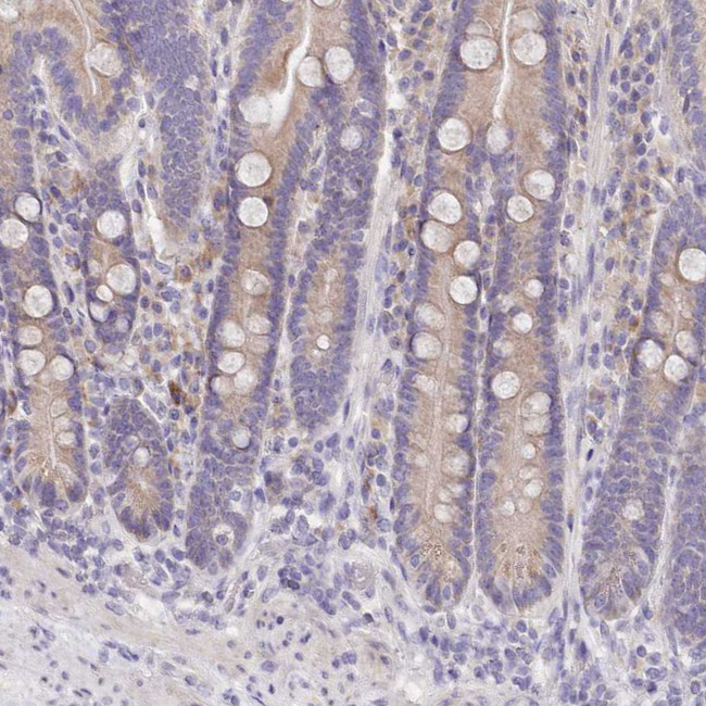 FAM83E Antibody in Immunohistochemistry (IHC)